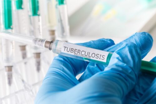 Eradicating tuberculosis: time to make this age-old dream a reality