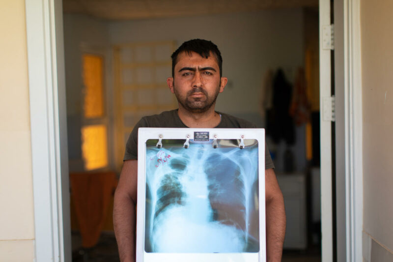 World TB Day: “We must continue to fight for those whose voices are not heard.” Bertrand Pfouminzhouer Kampoer’s point of view.